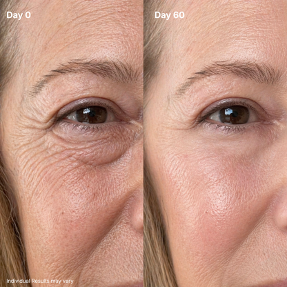 Eye Renewal Crème