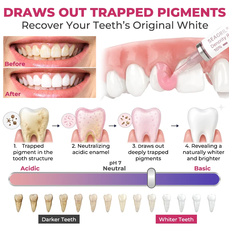 Juxek® DenPerm Cavity-Repair Natural Enamel Filling Gel
